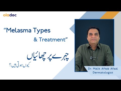 Chehre Par Chaiyan Kyun Hoti Hain – Epidermal vs Dermal Melasma | Melasma Causes, Types & Treatments thumbnail image