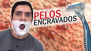 Livrar inchaços o se barbear dos após como