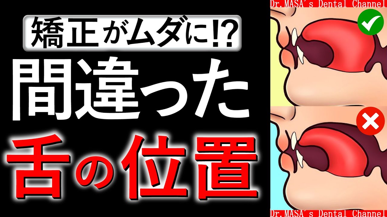 【歯列矯正】舌の位置を徹底解説！！改善するためのトレーニング方法も紹介！