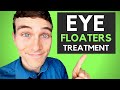 🔴How to Get Rid of Eye Floaters - 3 Eye Floaters Treatments