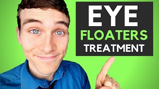 How to Get Rid of Eye Floaters  3 Eye Floaters Treatments