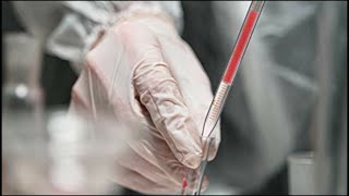 Top 10 Dropping Pipettes You Can Buy  February 2023