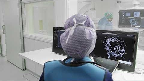 Simplifying and advancing 3D imaging with SmartCT in aneurysm coiling