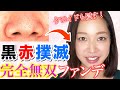 【鼻ベストコスメ】小鼻の脇にある黒ずみ赤み全て解消！完全無双のカバーファンデ！（いちご鼻・角栓・毛穴・ブラックヘッド永遠グッバイ！）