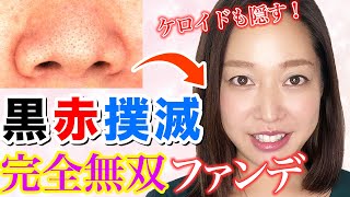 【鼻ベストコスメ】小鼻の脇にある黒ずみ赤み全て解消！完全無双のカバーファンデ！（いちご鼻・角栓・毛穴・ブラックヘッド永遠グッバイ！）