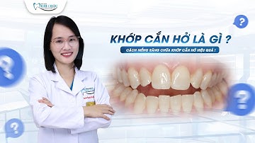 Khớp Cắn Hở Là Gì? Cách Niềng Răng Chữa Khớp Cắn Hở Hiệu Quả | Nha Khoa Minh Châu