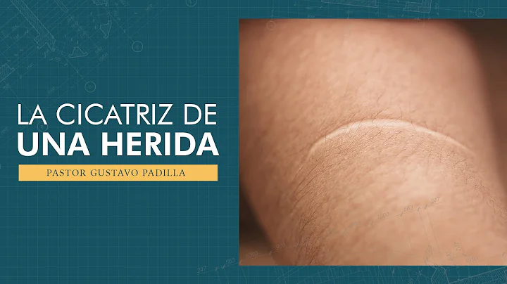 Pastor Gustavo PadillaLa cicatriz de una herida ma...