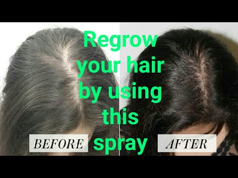 Revocos Hair Spray Best Hair Fall Solution Youtube