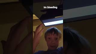 Omg Im Bleeding