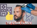 5 best hair transplant clinics