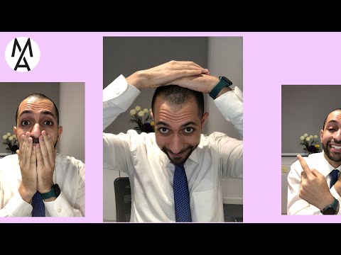 يا رجالة خلوا بالكم من حلاقة الشعر كويس جدا