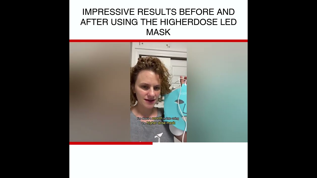 Impressive results before and after using the higherDose LED mask