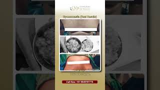 Same Body Different Confidence | Gynecomastia Treatment Vizag | Real Change with VJ’s Clinics Vizag