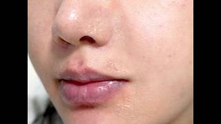 [미팩토리 돼지필링패드] 온몸 허물 벗겨낸 리얼 후기!!!! 각질타파!!
