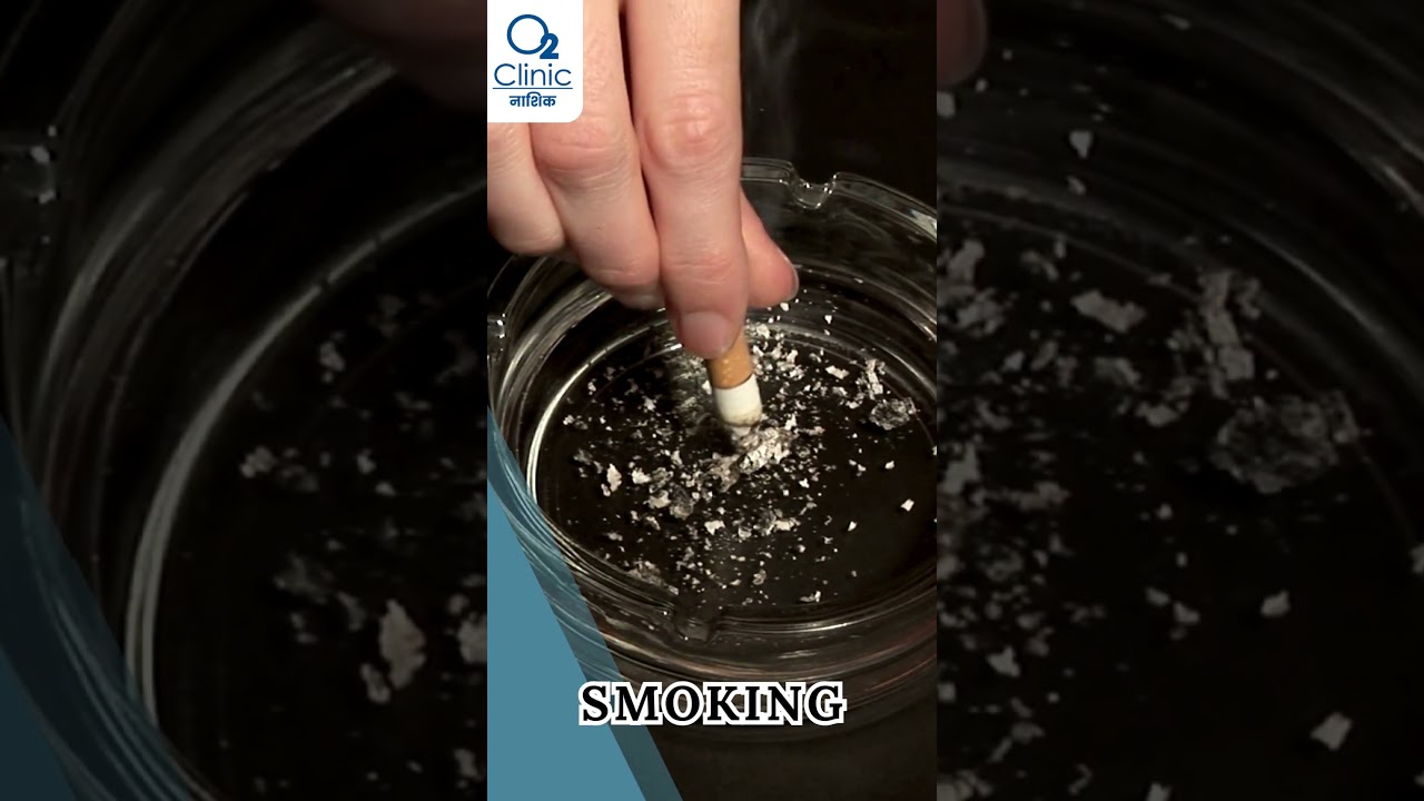 Mastering Arthritis Risks: Your Guide to Stronger Joints! 