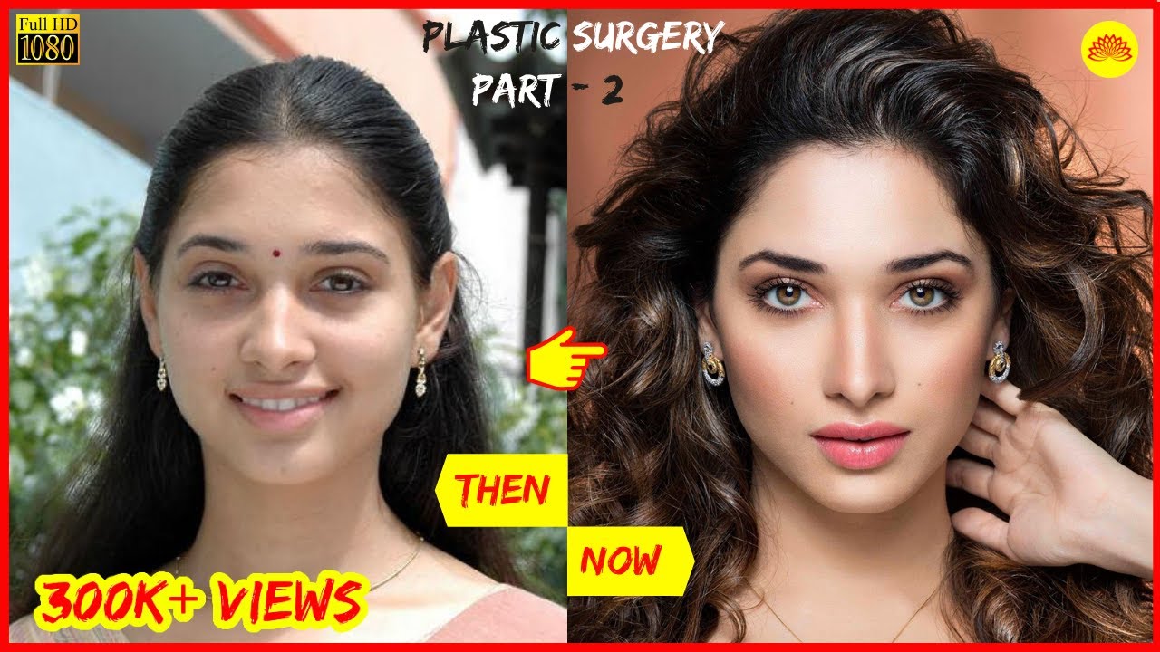 Shocking Plastic Surgery Before And After Of South Indian Actresses Part 2 Celebrity Life