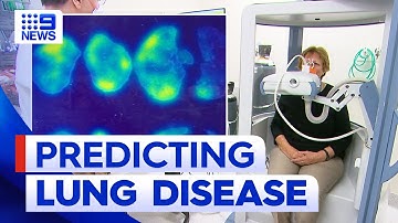 New software system to predict lung disease outcome for Australian patients | 9 News Australia