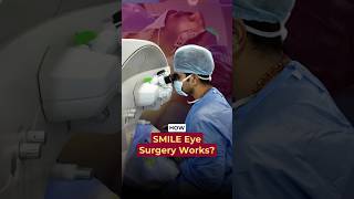 How SMILE Eye Surgery Works? - Dr. Advaith Sai Alampur | Envision LASIK Centre 👁️