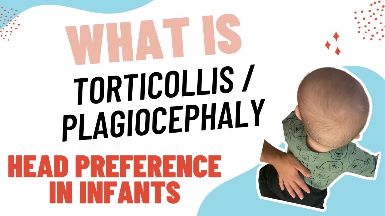 what-is-torticollis-plagiocephaly-in-newborns-how-can-it-be