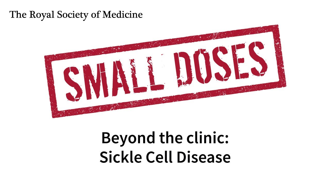 Royal Society of Medicine Small Doses: Beyond the clinic: Sickle Cell Disease
