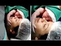 Emotional moment newborn clings to mothers face