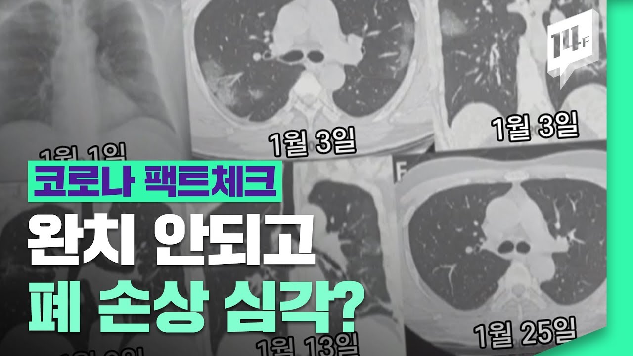 심각한 폐 손상? CT에 찍힌 하얀 폐 사진의 진실은? (with 중앙임상위원회 위원장, 서울아산병원 영상의학과 교수 ...