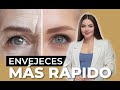 RELLENOS al rededor de los OJOS: Lo primero que ENVEJECE!!