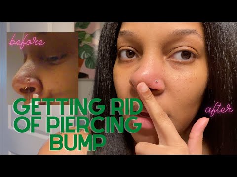 Say Goodbye to Bumps with NoPull Piercing Disc