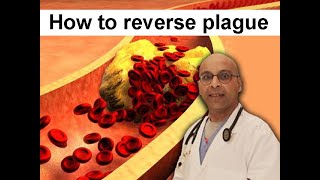 How to reverse arterial plaque