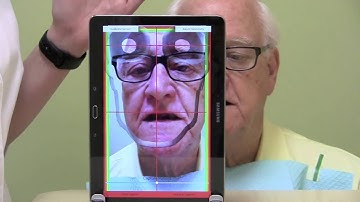 MaxAlign and the Edentulous Patient
