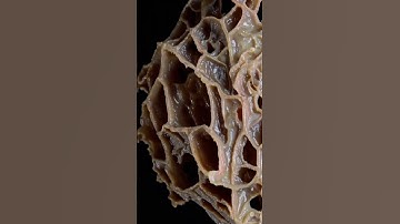 WARNING: THIS VIDEO WILL TRIGGER YOUR TRYPOPHOBIA! 😱💀 #disturbing #terrifyingtales #trypophobia
