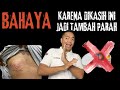 Bolehkah Pakai Balsam untuk Herpes? Ini Faktanya dari Dokter!