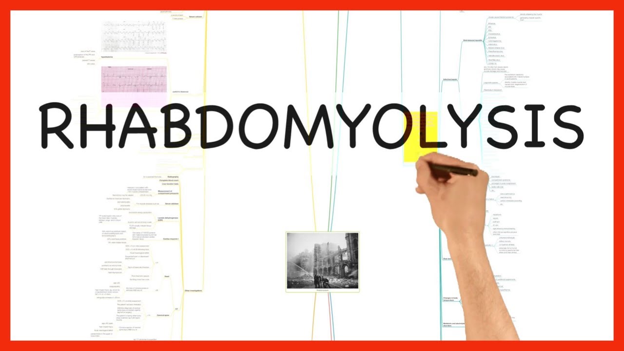 RHABDOMYOLYSIS
