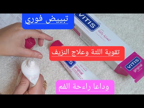افضل معجون اسنان فيتيس  لتبييض الاسنان بسرعة وعلاج اللثة سيلان اللثة