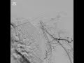 The TAME Lab: Shoulder Artery Anatomy.