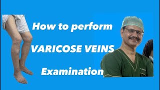 Varicose Veins Examination