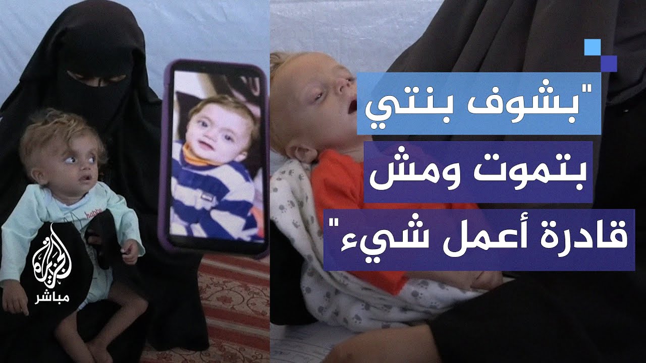 نسرين وأخوها طفلان من خان يونس حالتهم الصحية تسوء يوما بعد يوم