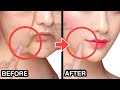 9mins antiaging face massage for droopy mouth corners sagging jowl laugh lines sagging cheeks