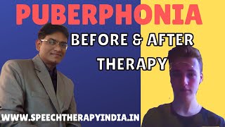 SLP Sanjay Kumar: Pre-Post Puberphonia | Online Voice Therapy | 10 days | Poland Boy | Voice Doctor