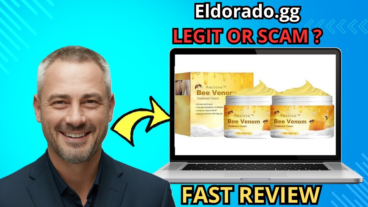 Awzlove Bee Venom Vitiligo Cream Review 2025 – Does It Really Work or Is It a Scam?