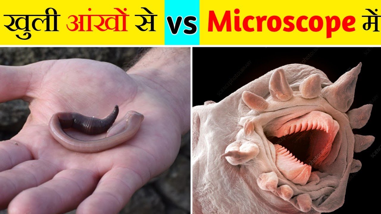 🔴 Earthworm Under [Microscope]🔥 Microscope में केंचुआ