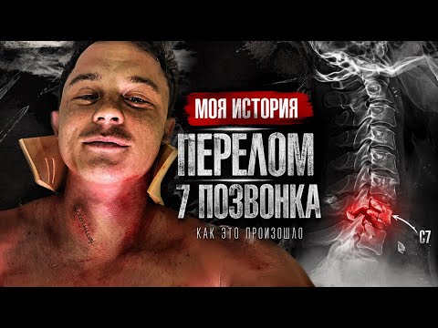 I dove in... AND BROKE MY 7TH VERTEBRA! My story