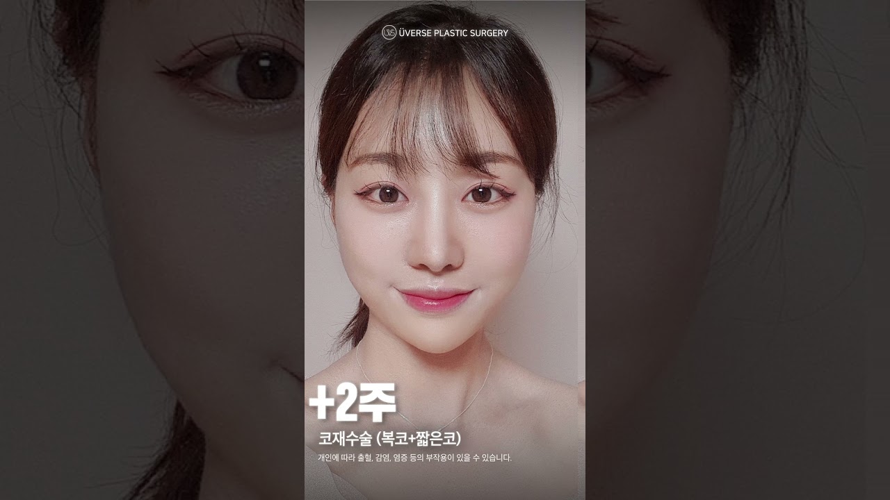 [Вивэрс гоо сайхны мэс заслын эмнэлэг] Би хөөрхөн! Вивэрс #shorts #хамардахинмэсзасал