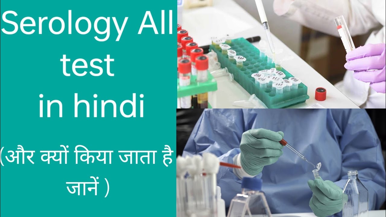 Serology lab test ( in hindi)