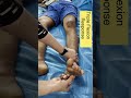 babinski with triple flexion response |  complete extensor planatar reflex  #neurology #shorts