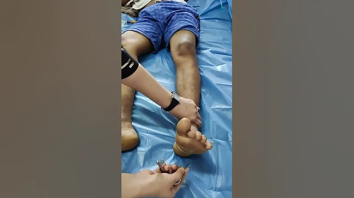 babinski with triple flexion response |  complete extensor planatar reflex  #neurology #shorts - DayDayNews