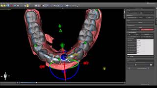 Beta Ortho Module Introduction Video