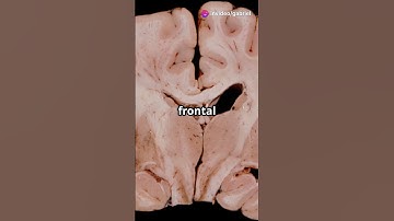 The Evolution of Consciousness