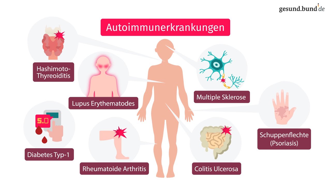 Was Sind Die Häufigsten Autoimmunerkrankungen www.youtube.com