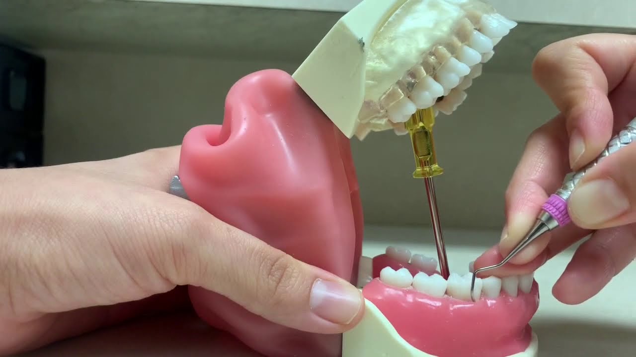 Universal Curette Demo